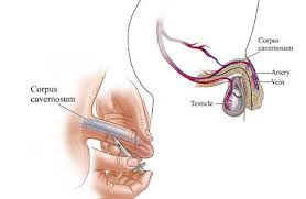 Penile Enlargement