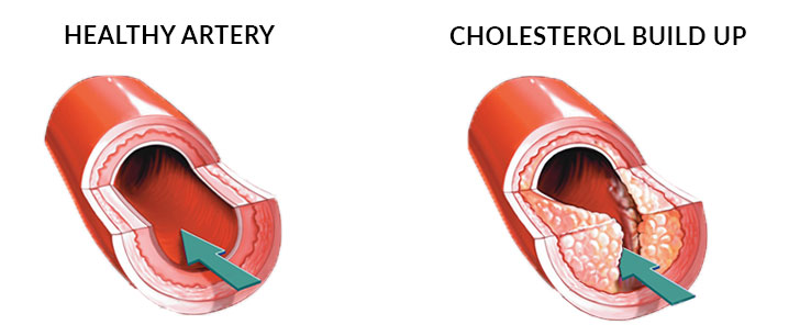Cholesterol Characteristics