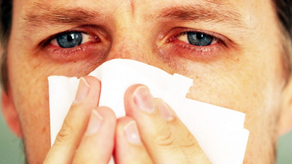 Can Allergies Influence Your Sexual Life?