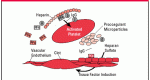 heparin-associated